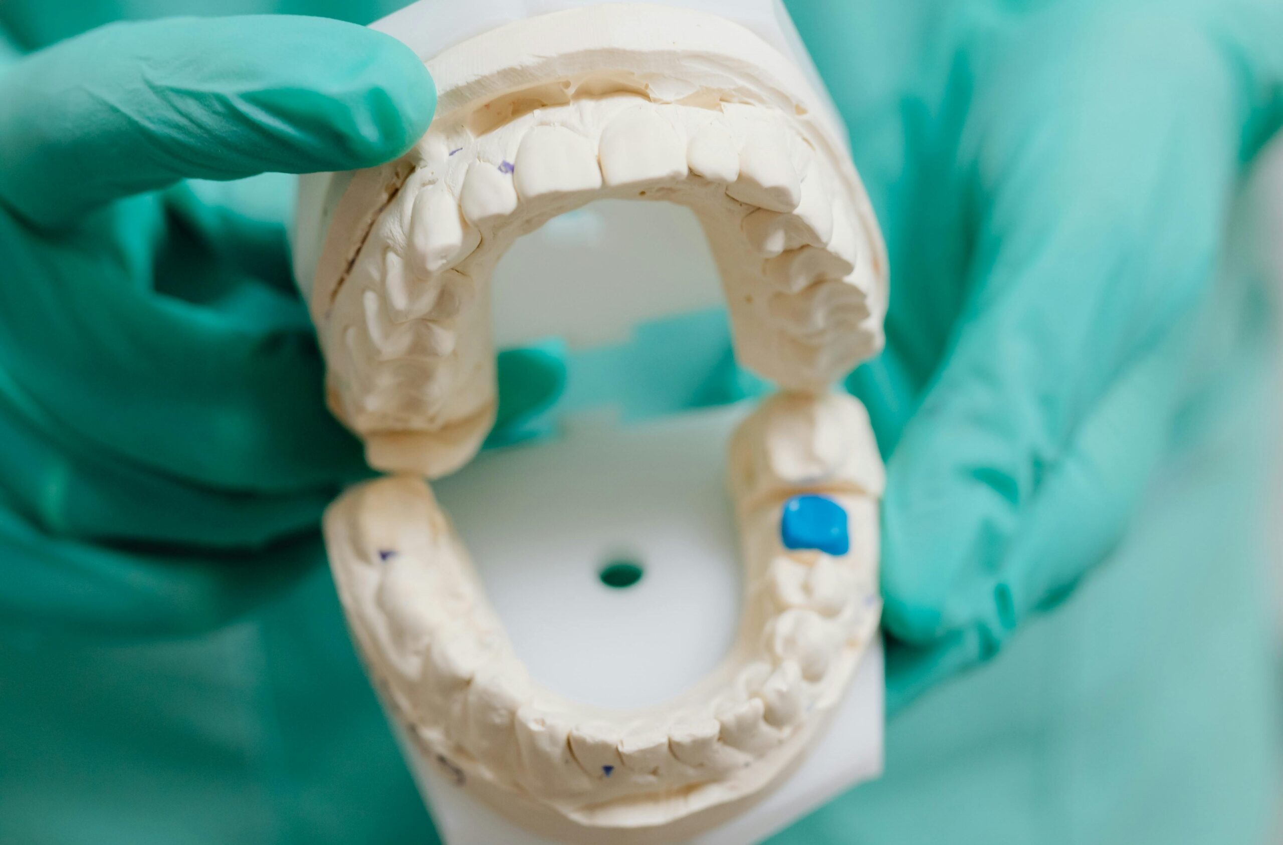 Artigos 3 Falha em implante dentário é sempre erro do profissional? Entenda os critérios técnicos